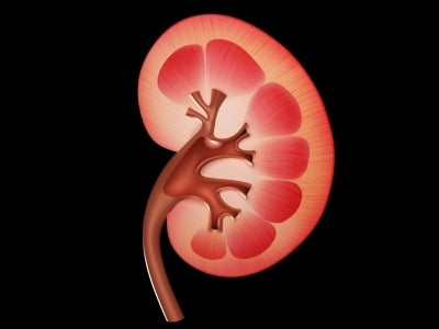 Risk of kidney failure