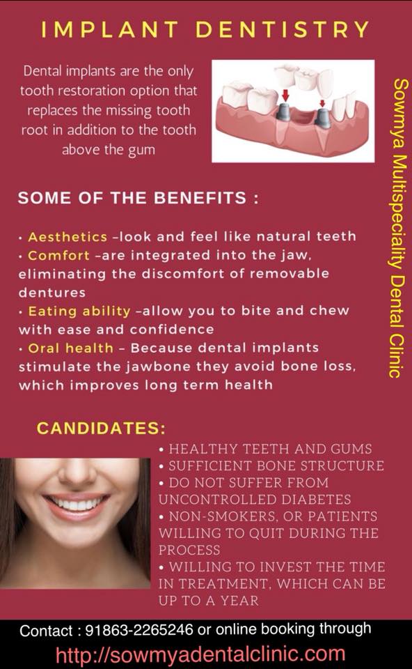 Dental Implants for teeth replacement | Get Life Tips